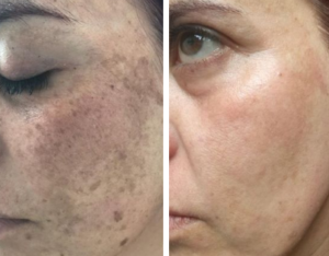 Captura de tela 2025-04-11 102939