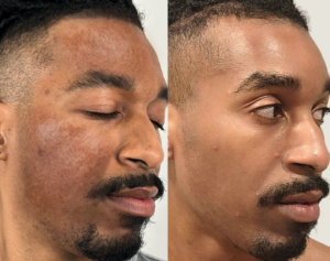 Captura de tela 2025-04-11 103101