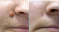 2ef65caf2c8eaee162b4f0b18c75f92e