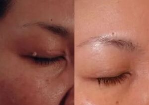 a6cf456876f3b1b21902476571fd2240